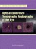 Optical_coherence_tomography_angiography_of_the_eye