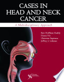 Cases_in_head_and_neck_cancer