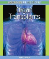 Organ_transplants